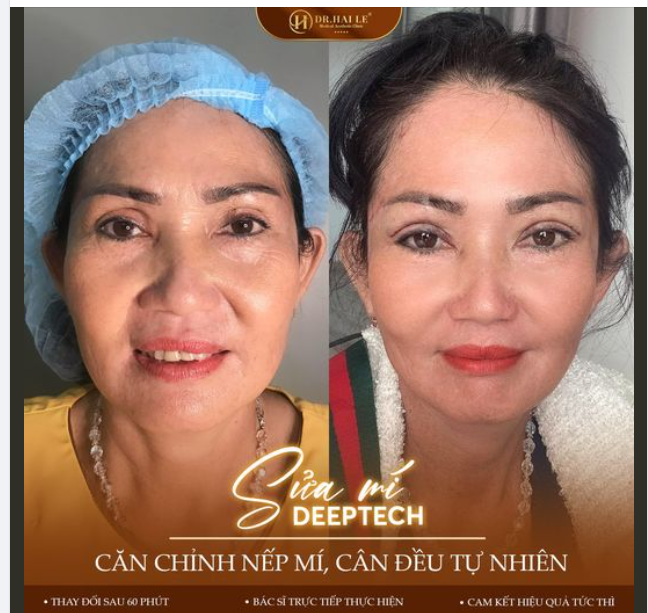 "U60 vẫn cứ phải đẹp, ai không sửa được cứ tìm bác sĩ Hải Lê" cô Khách chia sẻ