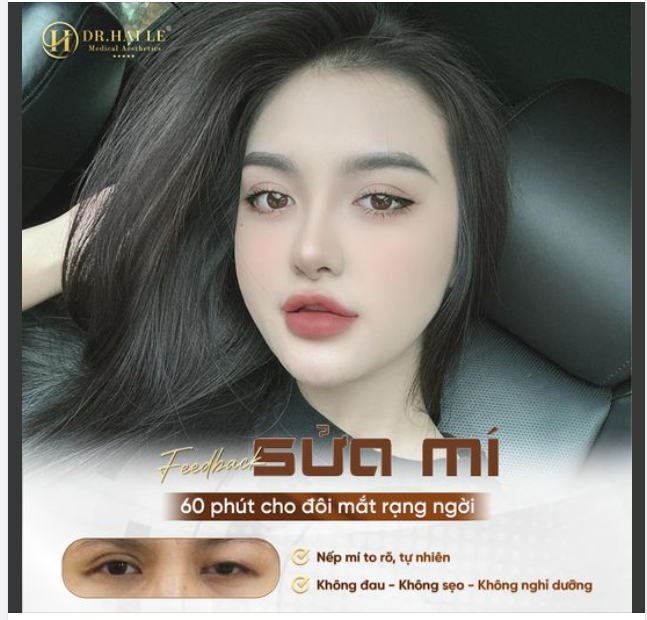"Biết vậy làm từ lâu rồi có phải xinh sớm rồi không, mất công sợ đau, sợ sưng" chị Khách chia sẻ