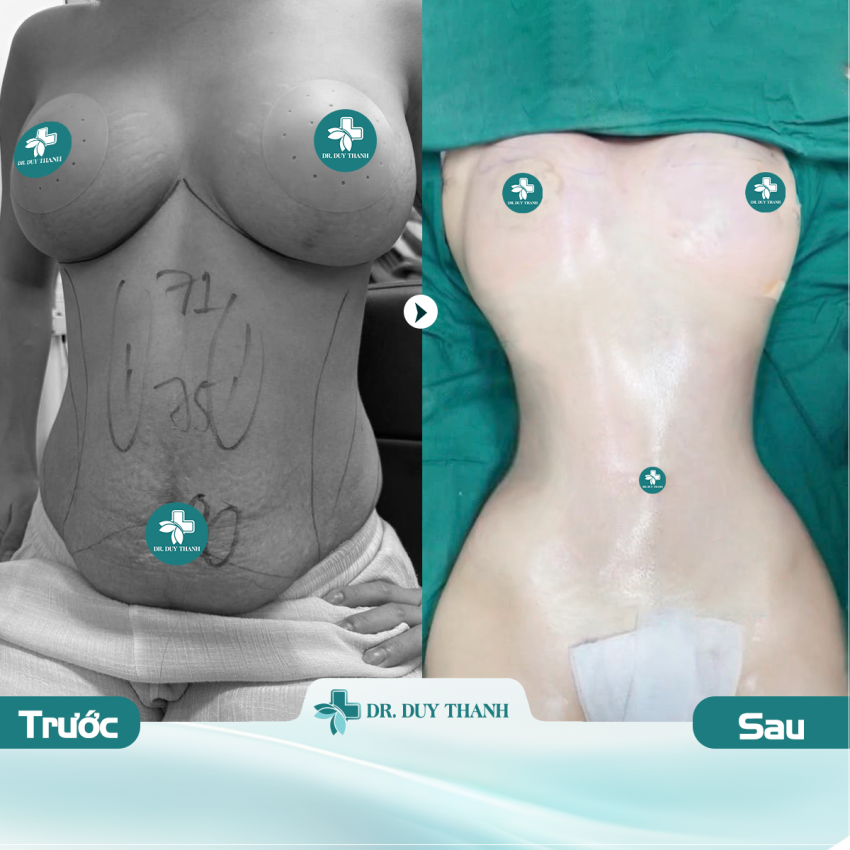 5 Sai Lầm Lớn Trong Phẫu Thuật Thẩm Mỹ