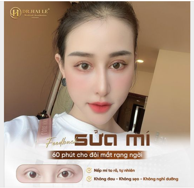 Tự ti - Ngại giao tiếp mỗi khi nhìn thẳng người đối diện! Tất cả khiến chị khách ngày càng thu mình hơn