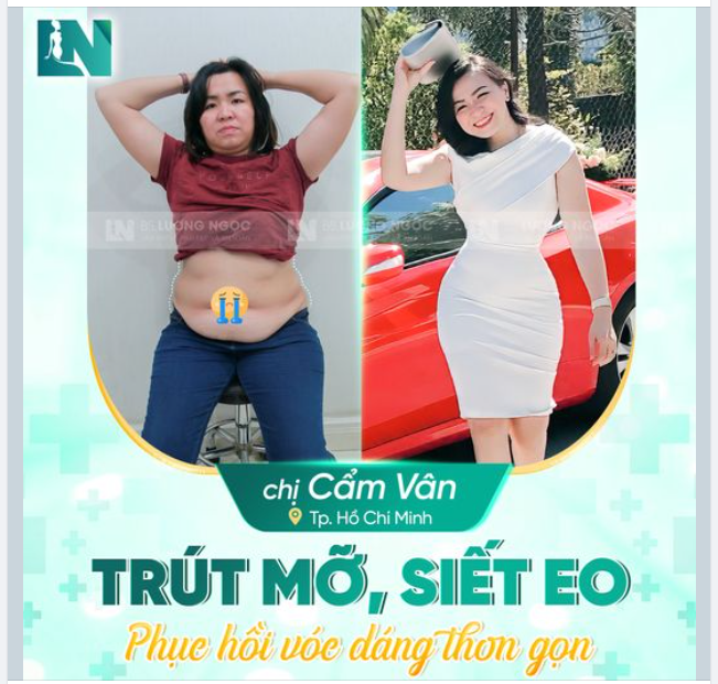 TẬP THỂ DỤC MÃI KHÔNG HẾT “EO NGẤN MỠ”, CHỊ VÂN QUYẾT ĐỊNH THỰC HIỆN HÚT MỠ TẠO DÁNG CÙNG EKIP BÁC SĨ LƯƠNG NGỌC