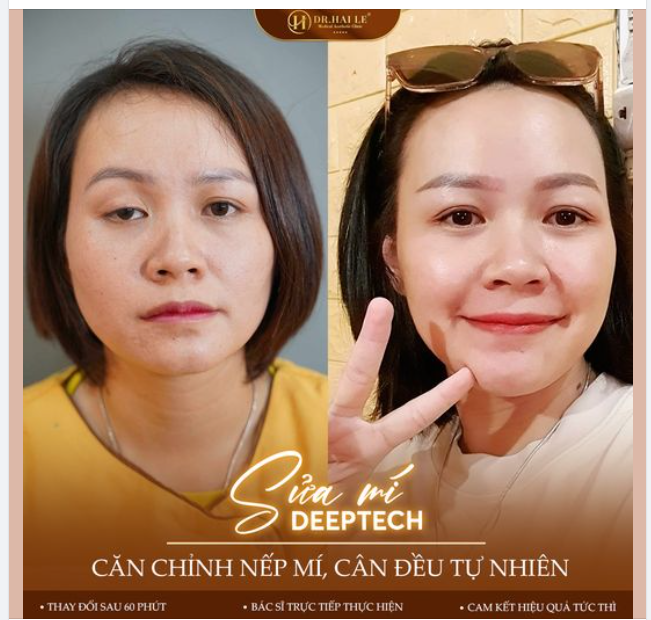 Tìm hiểu kỹ lưỡng + Đặt trọn niềm tim ​​​​​​​ Chị Khách 100% hài lòng với diện mạo mới!