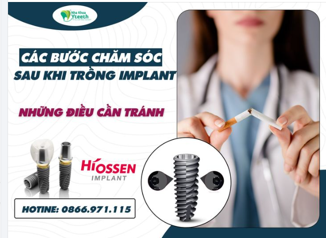 Cần tránh thực phẩm sau, để không ảnh hưởng đến quá trình lành thương và trụ Implant mới cấy ghép: