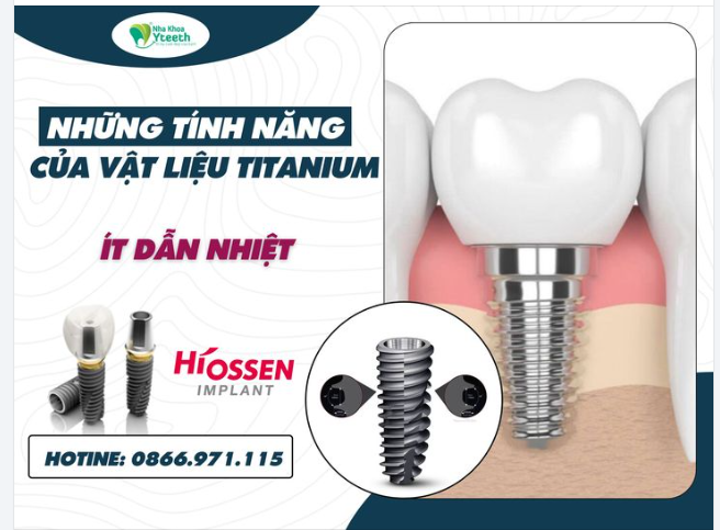 TẠI SAO TITANIUM LẠI ĐƯỢC DÙNG TRONG NHA KHOA - PHẦN 6: ÍT DẪN NHIỆT