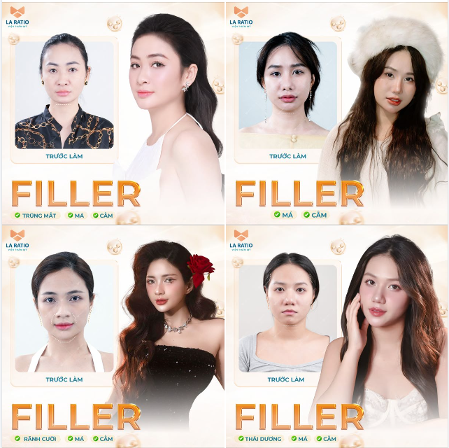 TOP NHỮNG MÀN “LỘT XÁC” NHỜ THẨM MỸ NỘI KHOA TẠI LA RATIO