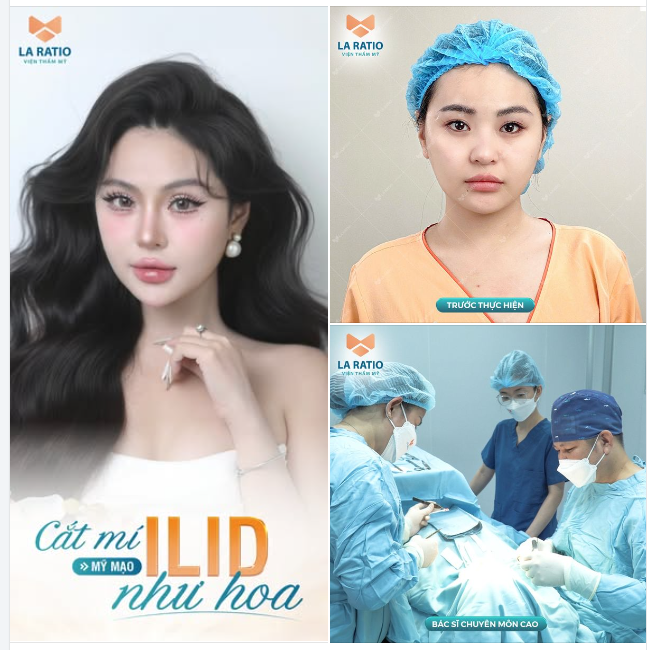 CẮT MÍ ILID - MỸ MẠO NHƯ HOA