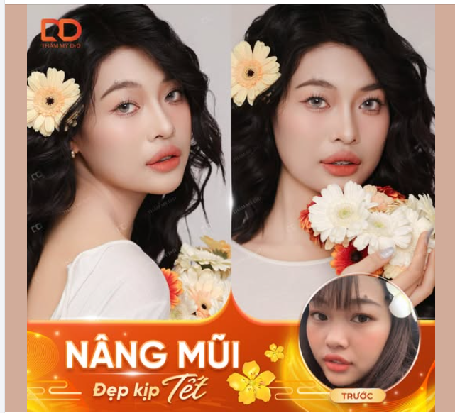 NÂNG MŨI BÂY GIỜ TẾT CÓ KỊP ĐẸP?