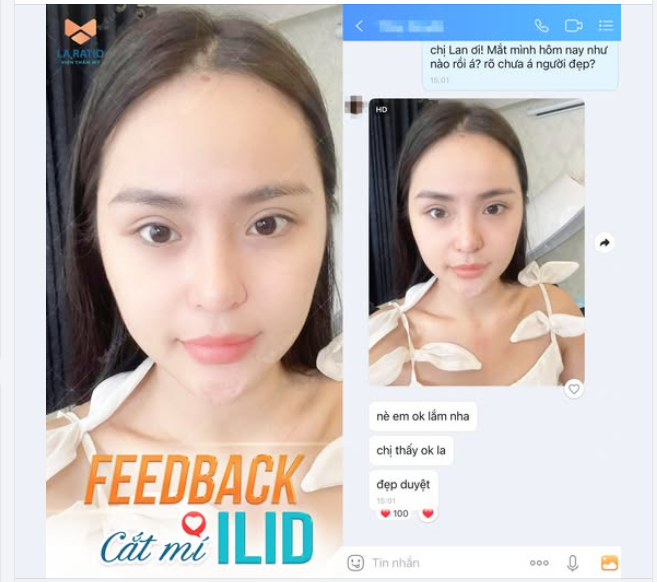 CẮT MÍ ILiD - ĐÔI MẮT THẦN THÁI KỂ CẢ KHI MẶT MỘC