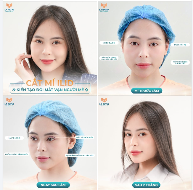 Vì sao nói phẫu thuật thẩm mỹ mang đầy tính nhân văn?