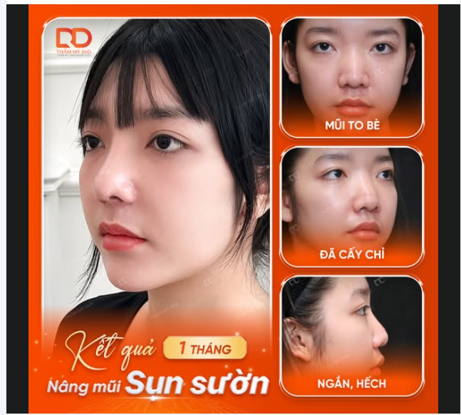 MŨI XẤU KIỂU NÀO SỬA KIỂU ĐÓ