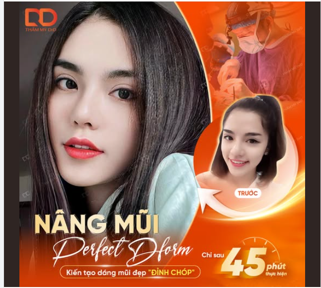 NÂNG MŨI PERFECT DFORM - KIẾN TẠO DÁNG MŨI ĐẸP "ĐỈNH CHÓP".