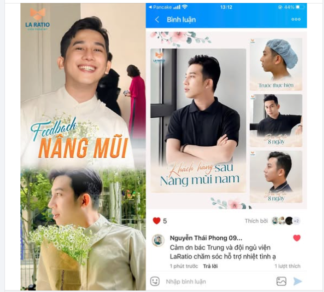 Feedback một chiếc mũi siêu nam tính được tạo bởi bàn tay của bác sĩ Võ Thành Trung.