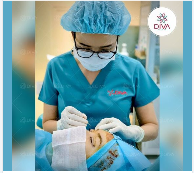 LÀM SAO ĐỂ NẾP MÍ KHÔNG BỊ THÔ TO, LỘ VẾT SAU KHI THỰC HIỆN CẮT MÍ MẮT?