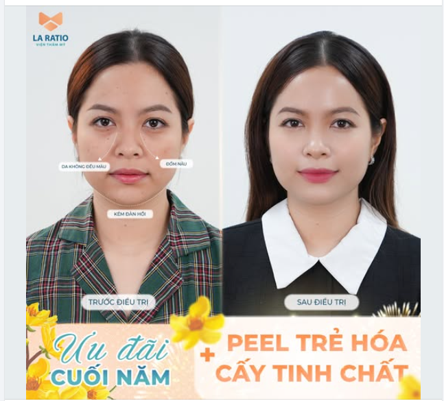 GIẢI CỨU LÀN DA THÂM SẠM, THIẾU SỨC SỐNG