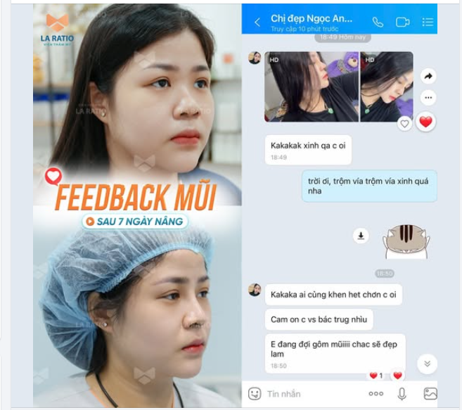 Nâng mũi đẹp tự nhiên, xu hướng làm đẹp không lỗi thời