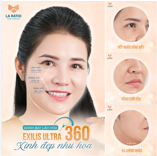 Ai cũng muốn xinh đẹp, nhưng làm gì để đẹp Nhanh - Hiệu quả - Không đau - Không phẫu thuật??