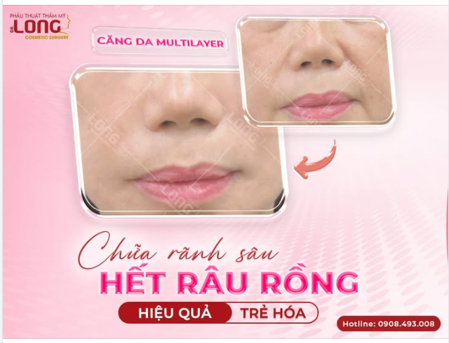 BỎ NẾP NHĂN - KHÔNG CÒN LĂN TĂN SỢ GIÀ