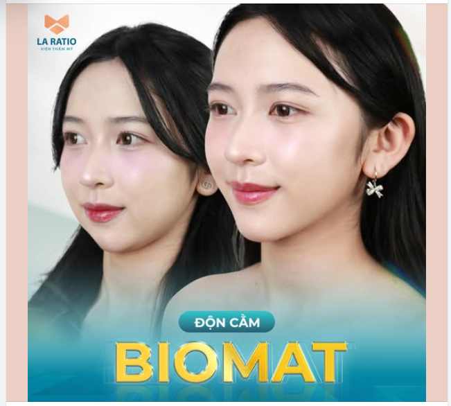 ĐỘN CẰM - BÍ QUYẾT TẠO KHUÔN MẶT VLINE THON GỌN