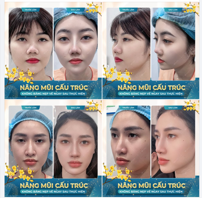 THAY DÁNG ĐỔI VẬN - LÀM ĐẸP KỊP TẾT