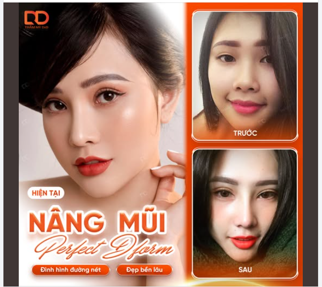 MŨI CAO XINH - TỰ TIN MÙA LỄ HỘI