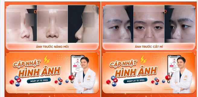 TRƯỚC GIỜ G  Cập nhật nhanh hình ảnh trước phẫu thuật các ca tiểu phẫu ngày hôm nay.