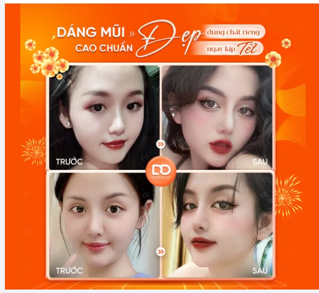 DÁNG MŨI CAO CHUẨN - ĐẸP ĐÚNG CHẤT RIÊNG