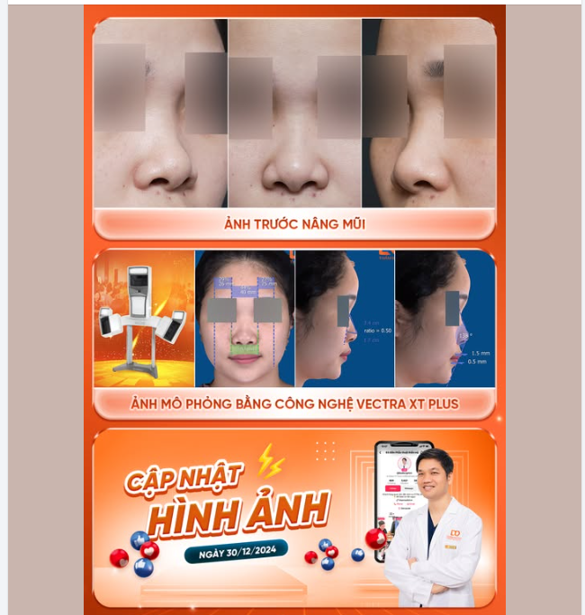 Càng gần cuối năm, chị em "chạy KPI" làm đẹp cực kỳ đông vui: Từ các dịch vụ đại phẫu, tiễu phẫu đến chăm sóc da.