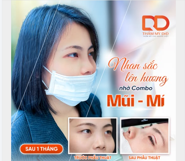 Nhan sắc thăng hạng chỉ sau 1 tháng nhờ combo mũi - mí tại DrD