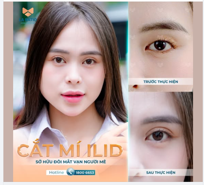Câu chuyện về đôi mắt biết nói