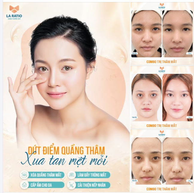 DỨT ĐIỂM QUẦNG THÂM - XUA TAN MỆT MỎI
