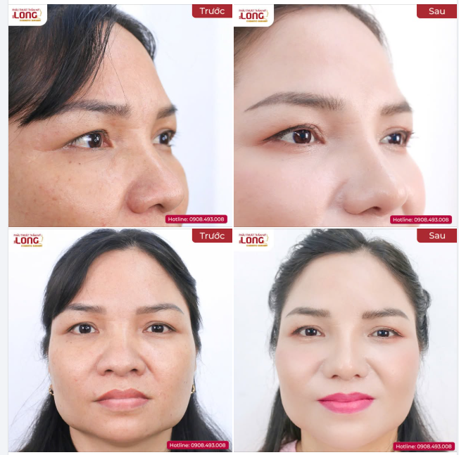 TÁI SINH SỰ TỰ TIN – HÀNH TRÌNH THAY ĐỔI DIỆN MẠO MỚI
