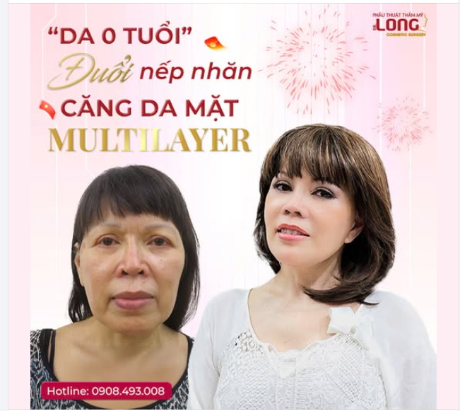 "DA 0 TUỔI - ĐUỔI NẾP NHĂN"