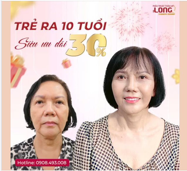 TRẺ RA 10 TUỔI - TẶNG ƯU ĐÃI LÊN ĐẾN 30%