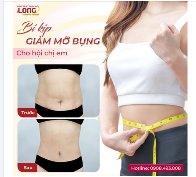 SAU KHI HÚT MỠ BỤNG – KẾT QUẢ NHƯ THẾ NÀO?