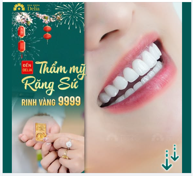 Hot. Gia hạn chương trình "Thẩm mỹ Răng Sứ Rinh Lộc Vàng 9999" !!!