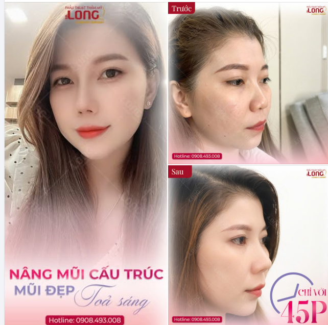 MŨI CAO XINH - ĐÓN TẾT LINH ĐÌNH