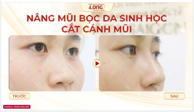 CẢM ƠN BẢN THÂN VÌ ĐÃ ĐƯA RA QUYẾT ĐỊNH ĐÚNG ĐẮN