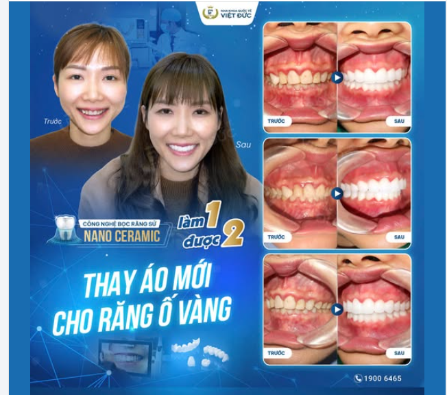 THAY RĂNG ĐỔI VẬN - RẠNG RỠ ĐÓN ĐIỀU MAY