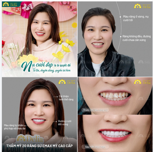 NỤ CƯỜI ĐẸP LÀ BÍ QUYẾT ĐỂ TỰ TIN, DUYÊN DÁNG HƠN TRONG NĂM MỚI 2025