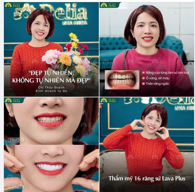 "ĐẸP TỰ NHIÊN, KHÔNG TỰ NHIÊN MÀ ĐẸP"