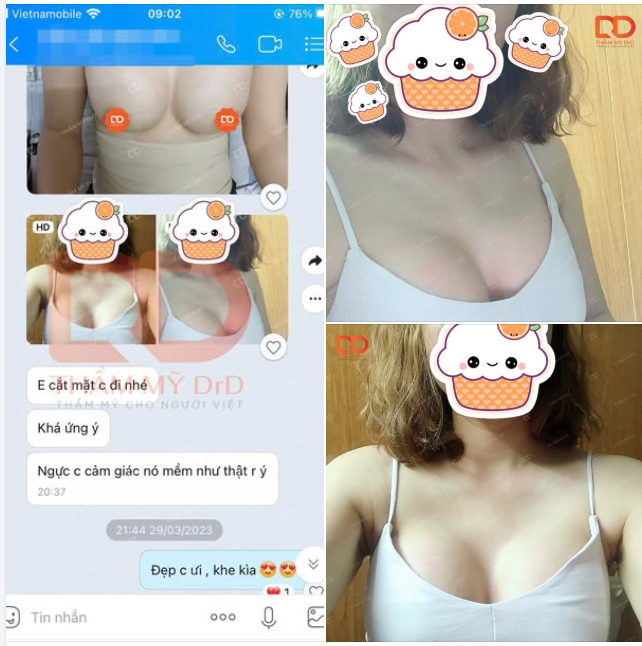 FEEDBACK KHÁCH HÀNG NÂNG V1 TẠI BÁC SĨ ĐIỀN
