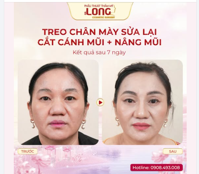 CHỌN ĐỊA CHỈ LÀM ĐẸP “NÉ XA” BIẾN CHỨNG THẨM MỸ