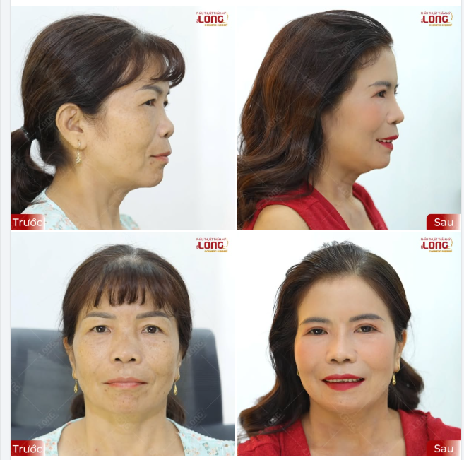 TOP NHỮNG NƠI NÊN ĐI TRONG NĂM 2025