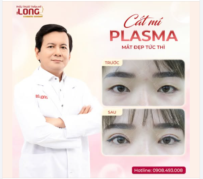 CẮT MÍ PLASMA - TẠO MẮT 2 MÍ KHÔNG VẾT TÍCH THẨM MỸ