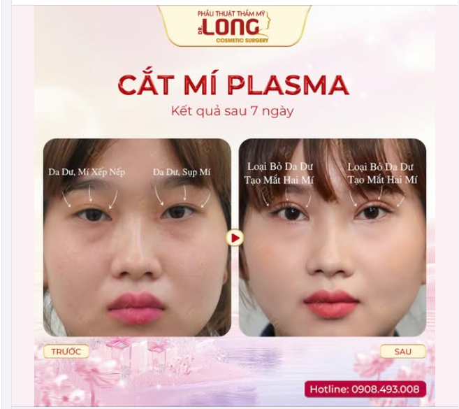ĐI ĐI EM  DO DỰ  TRỜI TỐI MẤT!