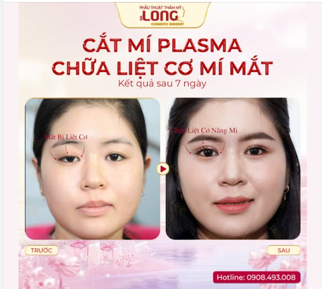 TRỐN “ÁNH NHÌN” LÀ CẢM GIÁC NHƯ THẾ NÀO, LÝ DO VÌ SAO?