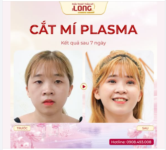 BỎNG TAY KHI VA PHẢI CHIẾC DEAL NÀY