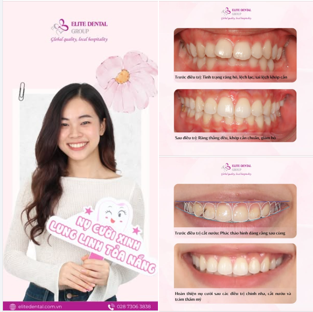 MANG NỤ CƯỜI VIỆT RA THẾ GIỚI - HÀNH TRÌNH CỦA HOÀNG OANH