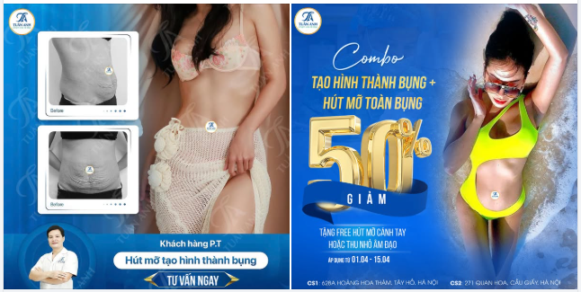 ĐÁNH TAN MỠ BỤNG – LẤY LẠI VÒNG EO TRONG MƠ