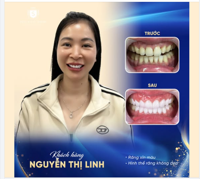 BẠN THÂN CƯỜI XINH, MÌNH CŨNG CƯỜI ĐẸP
